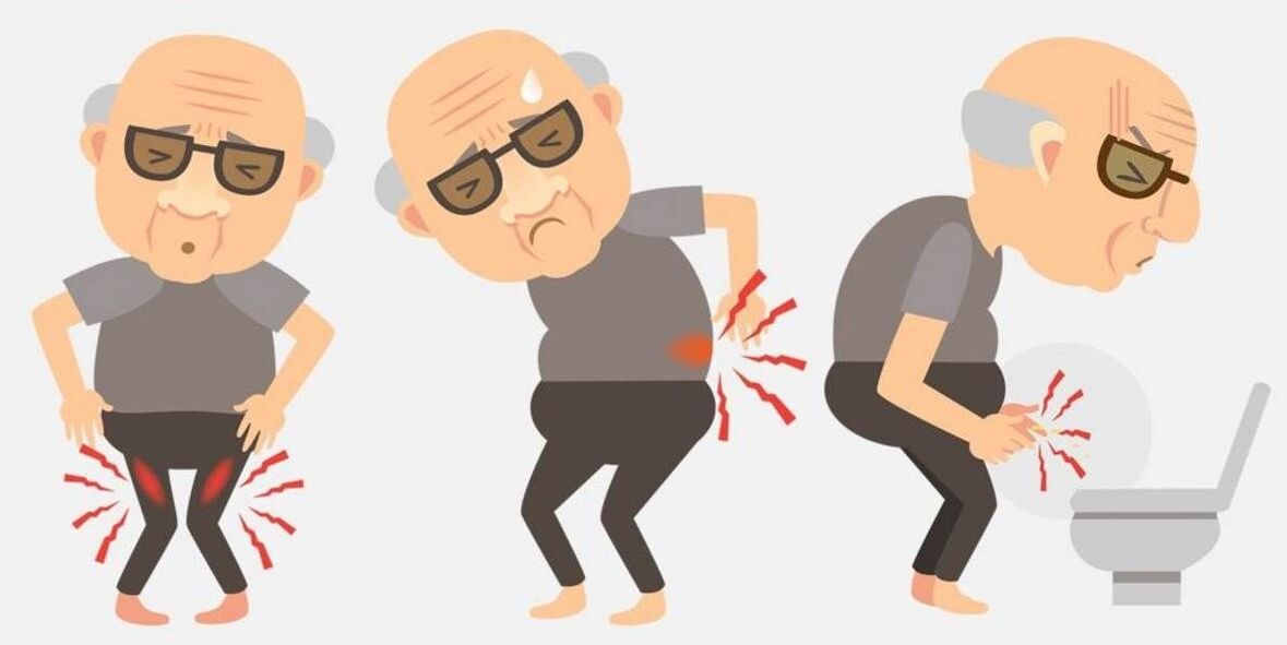 simptomi prostatitisa